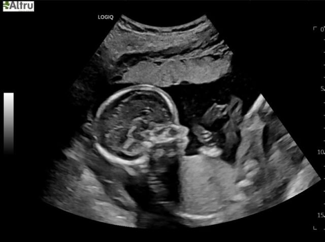 Another Baby Girl Stoner will be joining us this coming February 2026. God likes to give us strong little women. I know from kicks in the womb and outside the womb! 💛 Children are the best. God's invitation to grow up! 

Photo Credit: Kailey Louise Designs